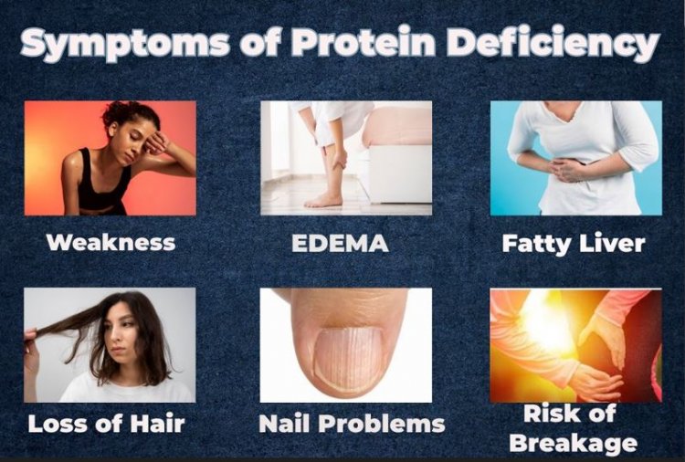Symptoms of Protein Deficiency and necessary supplements 